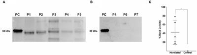 Fibronectin Fragments and Inflammation During Canine Intervertebral Disc Disease